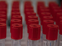 FDA одобрило первую полностью автоматизированную систему для забора крови из вены
