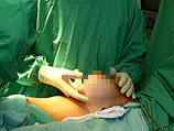 Во время операции по увеличению груди в одной из пластических клиник Тель-Авива