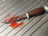 На автобусной остановке в Бат-Яме молодого мужчину ударили ножом в живот