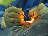 Польские врачи провели первую в мире экстренную операцию по пересадке лица