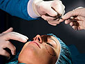 Израильские подростки чаще всего просят хирургов "подправить" нос, уши и увеличить грудь