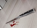 Отец напал на пятилетнего сына с раскаленным ножом