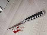 Отец напал на пятилетнего сына с раскаленным ножом