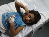 Раненая девочка в одной из больниц сектора Газы