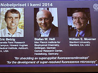 Нобелевской премии по химии удостоены исследователи флюоресцентной микроскопии