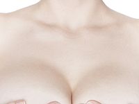 Реклама с обнаженной женской грудью стала причиной более 500 аварий в Москве