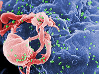 Британские ученые: ВИЧ мутирует и становится  менее агрессивным и опасным