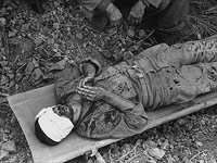 Американский солдат, раненный в сражениях за остров Окинава. Апрель 1945