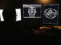 Рентгенологи ужесточают борьбу за свои права