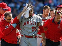 MLB: мяч, попавший в голову бейсболиста, стал причиной перелома черепа