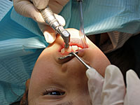Право на бесплатное лечение зубов получили дети до 16 лет