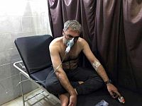 Сирийские курды обвиняют турецкую армию в применении напалма и химического оружия