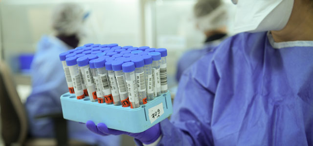 Данные минздрава Израиля по коронавирусу: за сутки выявлено 148 новых случаев болезни, 1 человек умер