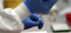 Израильские ученые нашли белок, управляющий молекулярным балансом и способствующий долголетию