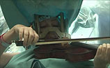 При операции на мозге в "Ихилов" скрипачка играла Моцарта. ВИДЕО