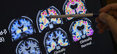 Ученые предложили метод смягчения тяжелых воспоминаний на фоне резкого роста ПТСР в Израиле