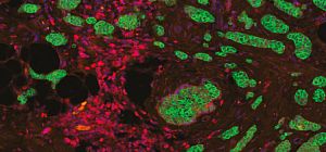 Израильские ученые заставили раковые клетки выдавать себя иммунной системе