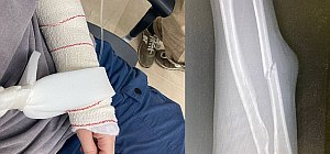 Правозащитницы пострадали при нападении ультраправых активистов на бедуинский Мухмас