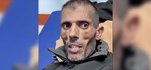 В соцсетях обсуждают истощенного "палестинского заключенного". Палестинские агентства молчат